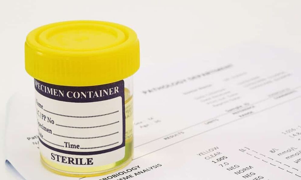 Você deve fazer um exame de urina antes de tomar antibióticos